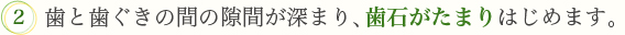 2．歯と歯茎の間の隙間が深まり、歯石がたまりはじめます。