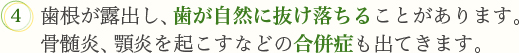 4．歯根が露出し、歯が自然に抜け落ちることがあります。骨髄炎、顎炎を起こすなどの合併症も出てきます。